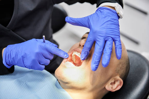 Best Urgent Care for Lost Fillings or Crowns in Steele Creek, AK