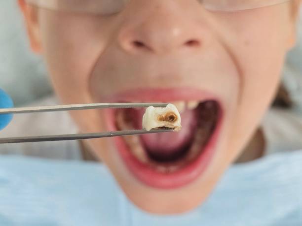 Best After-Hours Dental Trauma Care in Steele Creek, AK