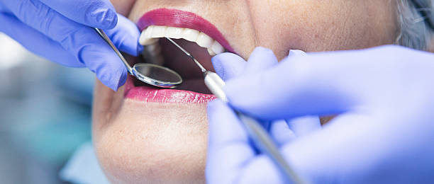 Best Emergency Treatment for Dental Infections or Abscesses in Steele Creek, AK